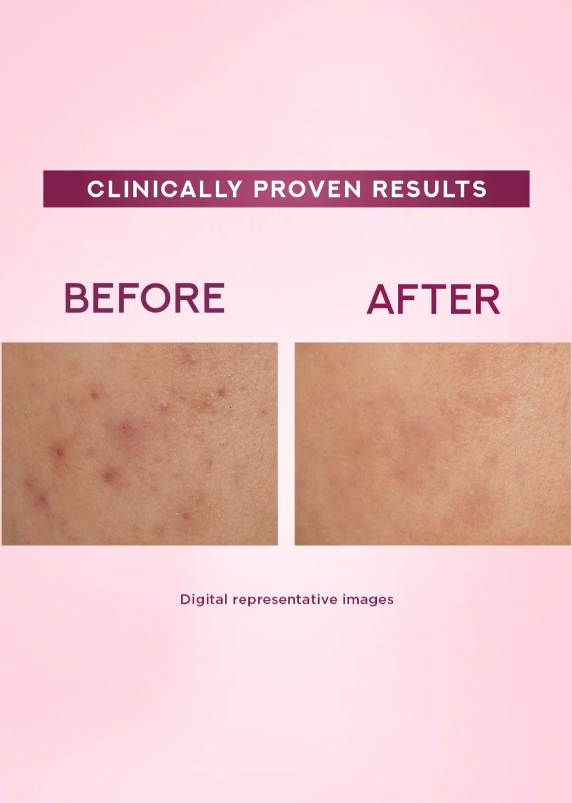 Pond's Bright Beauty Niasorcinol Light Crème with UV Filter - Image 2