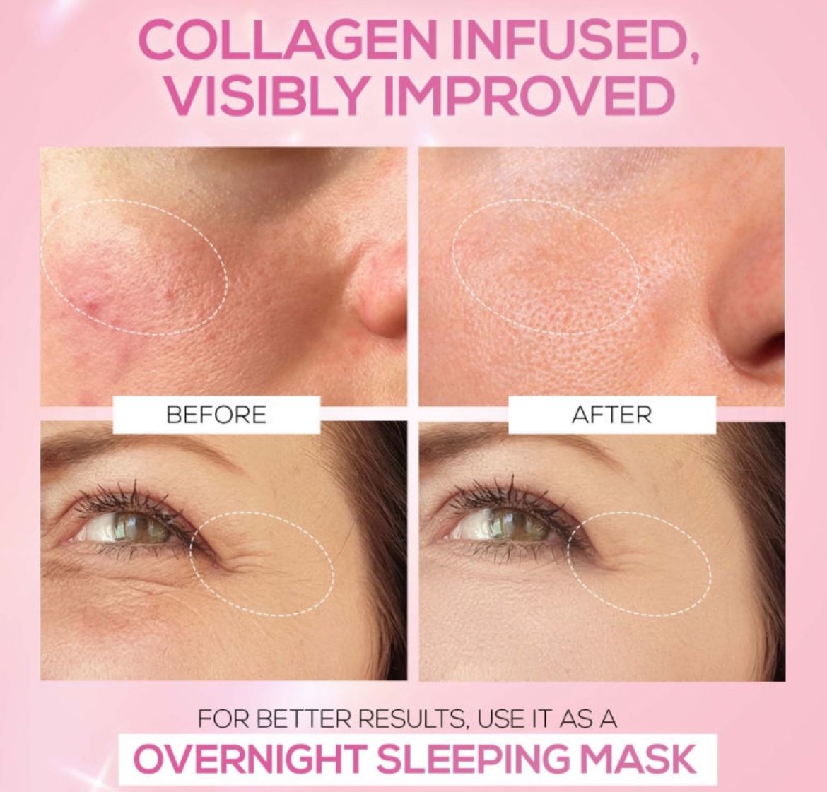 Pink Therapy Hydrolyzed Collagen Jelly Cream Mask - Image 2